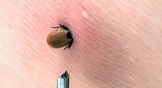 tick tick