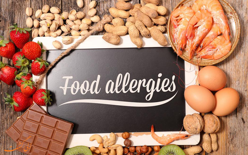 حساسیت غذایی حساسیت غذایی