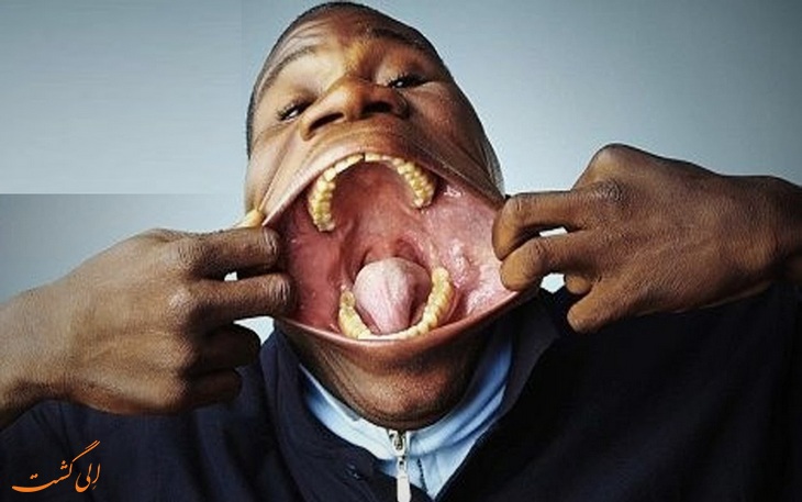 بزرگترین دهان دنیا