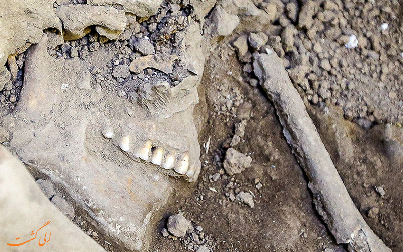 دندان های سالم مانده ی اسکلت دندان های سالم مانده ی اسکلت